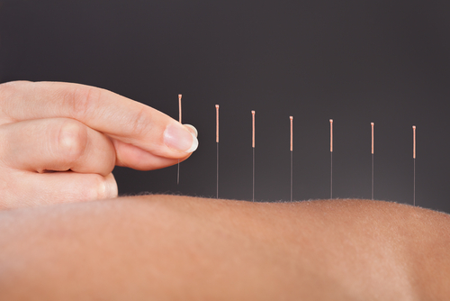 Does Acupuncture Help to Recover from Addiction?